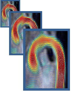 3D-PC MRI Velocity Field